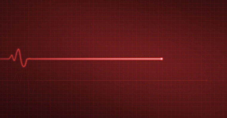 Editorial Image Pulse line