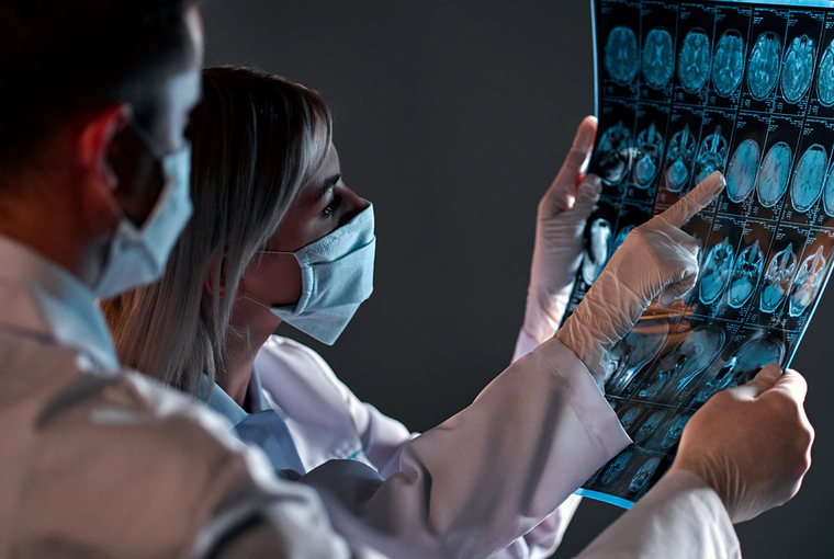 Two doctors are inspecting x-ray for Alzheimer