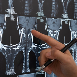 Doctor pointing at x-ray