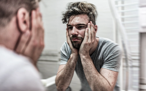 Man looking in mirror with damaged skin